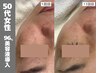 人気No1【エイジングケア】肌を守り育てるヒト幹96%美容液導入/結果重視