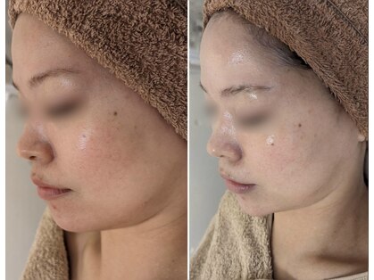 ジェニー(JENNI)の写真