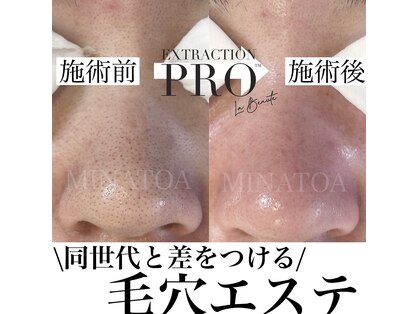 ミナトア(MINATOA)の写真