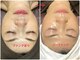 オージャス(OJAS)の写真