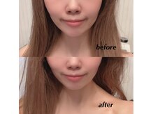 ビューティーサロン リリー(Lily)/