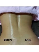 ビルーチェ(BELUCE)/ハイパーリボーン