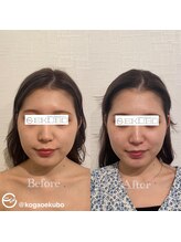 エクボ 立川店(EKUBO)/