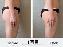 エミフル(emifull)/美骨ボディ・40代前半のお客様