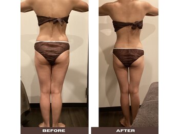 シェリーク 東京店/2ヶ月-5～7キロダイエット