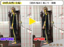 幸せのもり整体院/【20代女性／主婦】Oさん