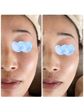 エムリシェ(M.riche)/ララピール