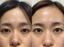 美ジン なかもず(美JIN)/フェイシャル