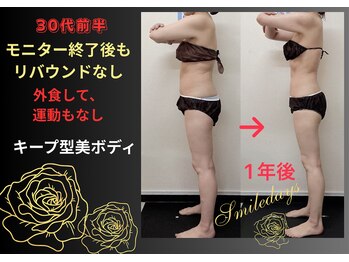 スマイルデイズ(Smiledays)/キープ型美ボデイ！