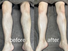 ムート(Mut.)/メンズ脱毛／脚