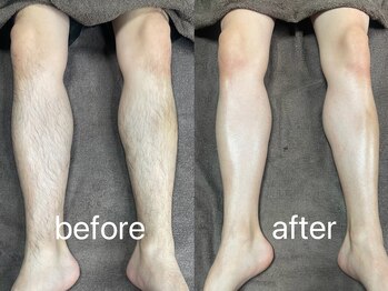 ムート(Mut.)/メンズ脱毛／脚