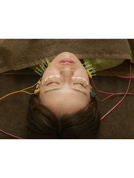 鍼灸施術を受けたい