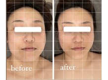 ジーニー(Genie)/フェイシャルご予約で小顔矯正！