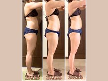 リライブ 亀有店(Re:Lives)/全身ビフォーアフター【痩身】