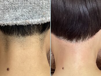ディスイズミー シュガーリング(This is me Sugaring)の写真/【アメ村/堀江】脱毛始めてみたい方必見！シュガーリングでつるすべのお肌へ◎お気軽にお越しください♪