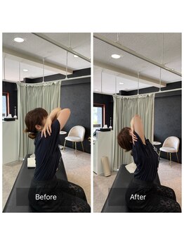 ナオル整体 広島福山院(NAORU整体)/猫背/巻き肩→Before/After