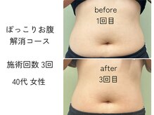 ほねつぎ一休さん 宇品店/ぽっこりお腹解消コース