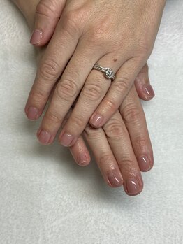 オランダエステティック(Holland Esthetics)/ワンカラー