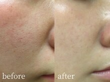 サロンナナジュウニ(Salon72)の雰囲気(何をしても改善しなかったお肌悩みお任せ下さい。)