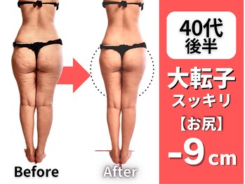 マルデビジュ 西宮(Mar de Bijou)の写真/西宮の美脚専門店◎履けなかったパンツも似合う脚へ。遠方来店も多い大人女性の結果重視の下半身痩せ専門店