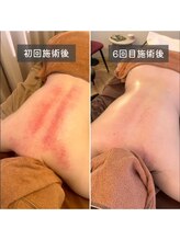 エービューティーサロン 松山店(A BEAUTY SALON.)