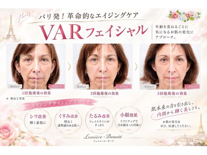 リュミエールボーテの写真