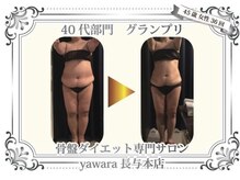 Before＆After Contest　4th 40代部門グランプリ獲得☆長崎痩身
