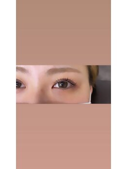 リンクス(links)/次世代ラッシュリフト