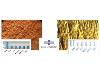 フェイシャルスタイリストサロン 四谷店/ケア例(54)