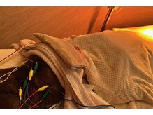 デルタエヌピー63+(δnp63+)/お客様施術例【小顔/薬院/福岡】