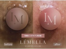 エミリエボーテの雰囲気（部位の金額やセット割については公式LINEまたはインスタへ☆）