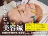 2回目以降［肌育で土台から変える］立体造顔美容鍼7000円→5000円