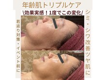 ヴィクトワール シュエット