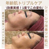 ヴィクトワール シュエット