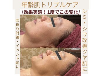 ヴィクトワール シュエット