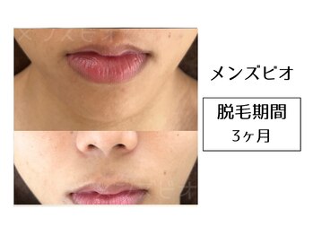 メンズビオ 神戸三宮店/