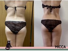 ヨサパーク ミッカ 学芸大学(YOSA PARK MiCCA.)/驚愕の結果パート４