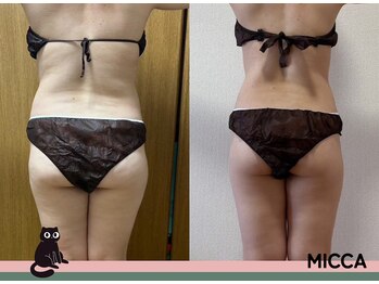 ヨサパーク ミッカ 学芸大学(YOSA PARK MiCCA.)/驚愕の結果パート4