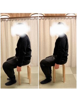 ツリー鍼灸整骨院 吹田店(TREE鍼灸整骨院)/長年悩んでいる腰痛に