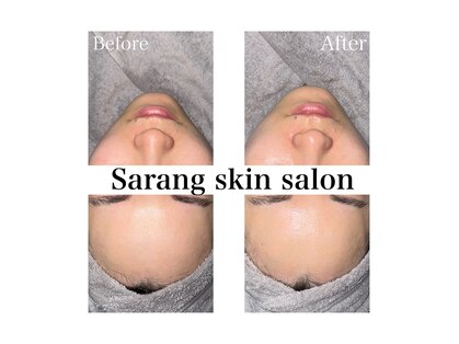 サラン スキンサロン(Sarang skin salon)の写真