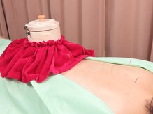 鍼灸治療院養源堂 西小山院/深部から温めるお灸