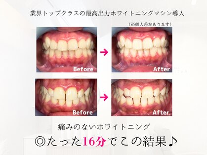 ホワイティア(WhiTeA)の写真