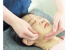 白記漢方堂鍼灸院(HAKU KI)/美容鍼