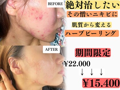 レーヴ(REVE)の写真