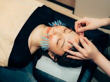 くすの樹接骨院 整体院 多 布施院/[美容鍼/鍼灸]リフトアップ/小顔