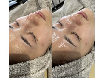 アイアール(ir)/