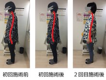 ストラボ 横浜店/ビフォーアフター６