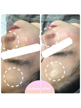 ミュー 植田店(mieux)/◆ビフォーアフター