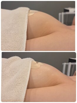 ルナリア ルクス 志木南口駅前店/バストアップ 下垂ケア