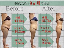 ヴィズクラブ バイ ビネル(Vi's CLUB by BINEL)/痩身before/after